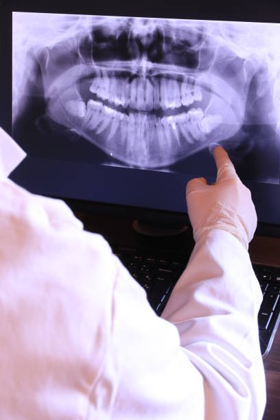Best Emergency Broken Tooth Repair in Edwardsvle, IL